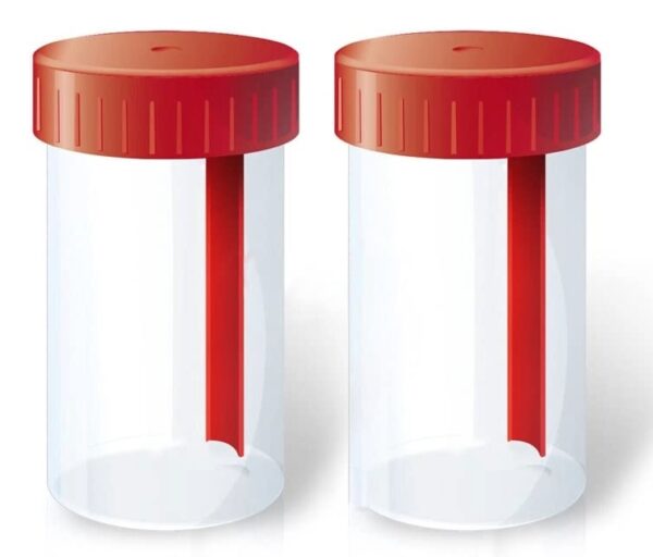 Set 2 Contenitori per Raccolta Feci, 60 ml, Sterili con Paletta, Chiusura Ermetica ed Etichetta Dati, Per Analisi Coprologiche, Temperatura 15-25°C - immagine 1